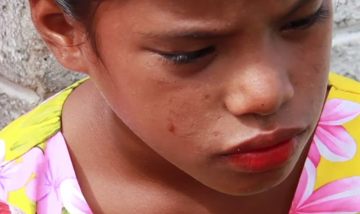Our Nukes, Their Kids In “Our Nukes, Their Kids” we talked to high schoolers from the Marshall Islands to learn about the Marshallese culture and the impact that United States’ nuclear testing had on the lives of Marshallese youth